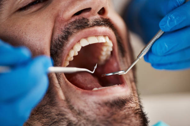 Best Urgent Dental Care for Toothaches in Charlotte, MI