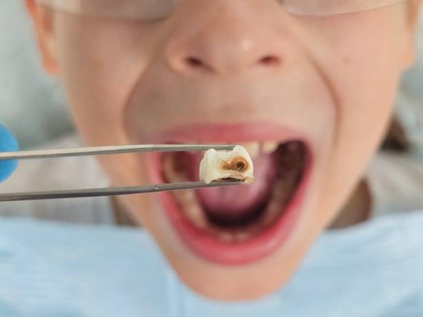 Best Emergency Denture Repair in Charlotte, MI